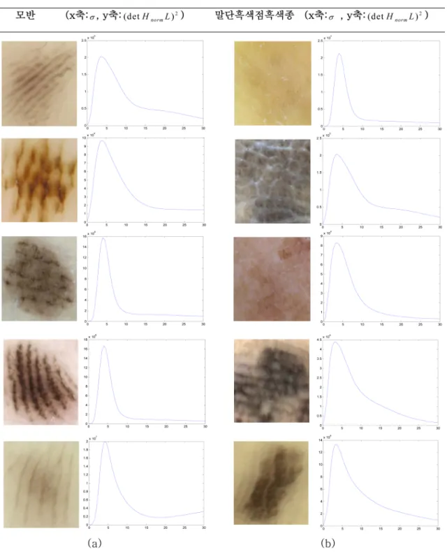 그림 10. 여러 영상들에 대한 스케일 공간 분석 (a) 모반 영상들과 (det H norm L) 2  연산 결과, (b) 말단흑색점흑색종 영상들과 (det H norm L) 2 연산 결과.