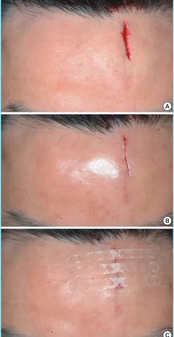 Fig. 1. Applying Leukosan SkinLink