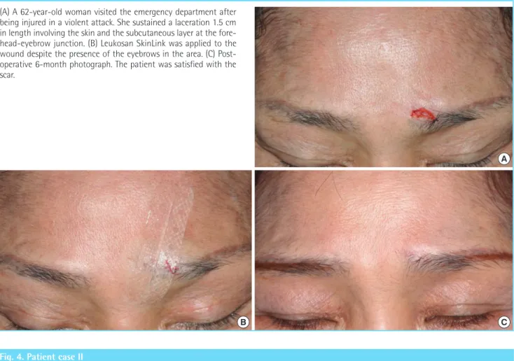 Fig. 4. Patient case II