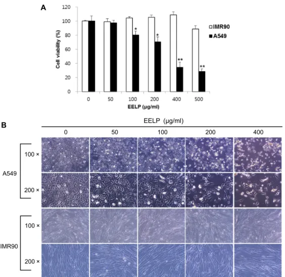 Fig.  1.  Effects  of  EELP  on  cell  growth  and  morphology  in  human  lung  carcinoma  A549  cells