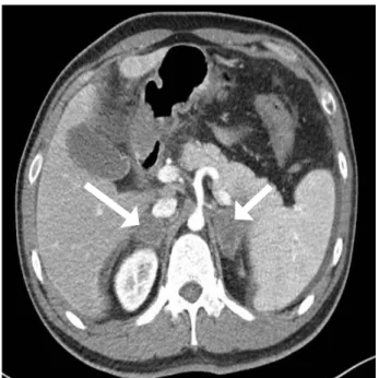 Figure 2. Computed tomography image of abdomen at admission. 