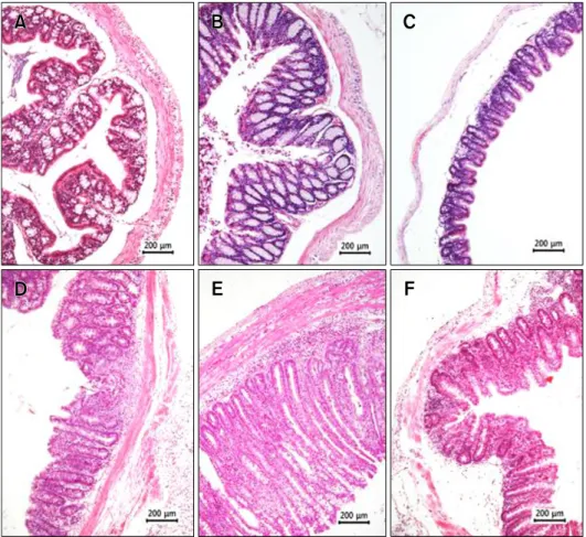 Figure 2. Histology. Micrographs of  the ascending colon (A, D), descending  colon (B, E), and cecum (C, F) of the  interleukin-10 wild type (IL-10 +/+ ,  A-C) and IL-10 knockout (IL-10  −/− )  mice (D-F)