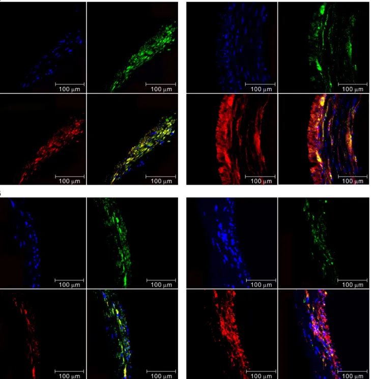Figure 9. Expression of neuronal nitric oxide synthase (nNOS) and inducible nitric oxide synthase (iNOS) in the proximal (A) and distal (B) colon  in interleukin-10 wild type (IL-10 +/+ , left panel) and IL-10 knockout (IL-10 −/− , right panel) mice (×200;