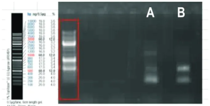 Fig. 4. Polymerase chain reaction (PCR) of the CDR3 region of im- im-munoglobulin heavy chain gene was performed with formalin-fixed  paraffin-embedded tissue samples