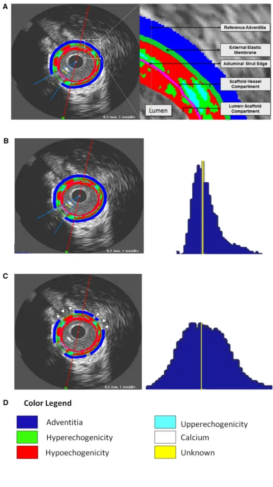 Fig. 1 Differential echogenicity methodology.