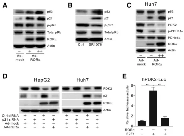 Fig. 4. Inhibition of PDK2 expression by RORa is p21-dependent. (A) Western blotting analysis of p53, p21, and p-pRb protein levels, in HepG2 cells overexpressing RORa (1, 50 multiplicities of infection [MOI]; 11, 100 MOI)