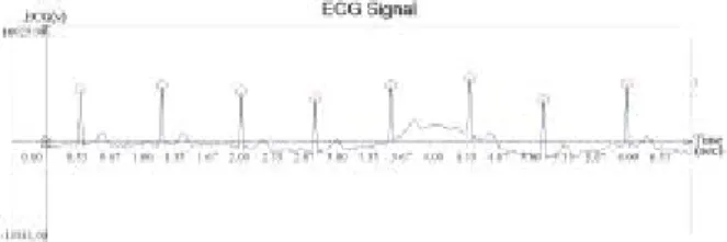 Fig. 5 RR interval time series
