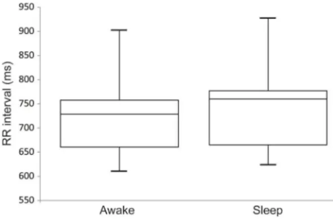 Fig. 6 Plot box for the RR interval between awake and sleep status