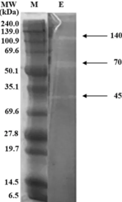 Fig.  6.  Zymogram  analysis  of  agarases.  The  molecular  masses  of  the  enzymes  were  45,  70  and  140  kDa