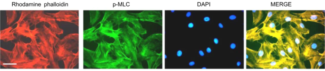 Fig.  2.  pMLC  and  actin  co-localized  in  normal  FRC.  FRCs  were  treated  with  phalloidin  and  anti-pMLC  antibody  for  1  hr  and  examined  for  changes  in  F-actin  distribution  (phalloidin  staining)  and  p-MLC