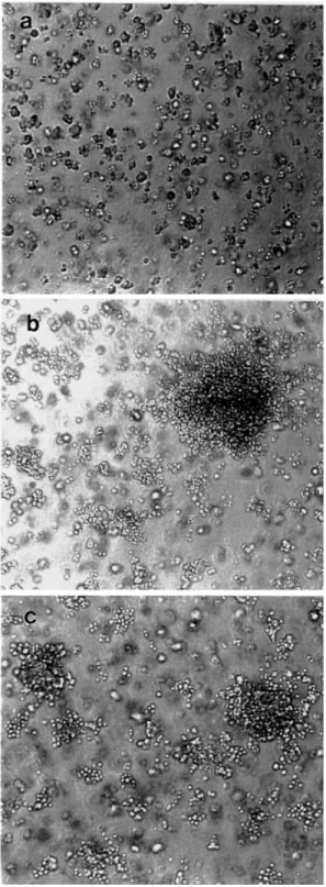 Fig. 2. Cells overexpressing PLD isozymes display a transformed phenotype. Cells stably expressing vector alone (a), PLD1 (b) and PLD2 (c) were seeded in cell suspensions as described in Materials and methods.