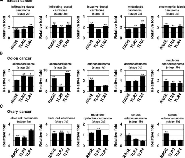 Fig.  3.  The  expression  of  RAGE,  and  TLR2/4  in  human  tumors.  real-time  qRT-PCR  data  showing  the  expression  of  RAGE  and  TLR2/4  mRNA  from  the  indicated  tumor  types  and  histological  stages  (TNM  classification)  of  breast  (A),  