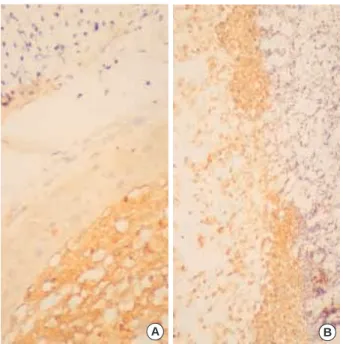 Fig. 7. The skin of the control rat (A) is negative for transforming growth factor (TGF)- 1, but the regenerated skin after injury with TGF- 1 antisense oligonucleotides (ODNs) injected rat (B) expresses TGF- 1.