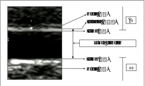 Fig. 2. Measurement of lumen diameter were taken from the anterior interface between intima and media to the posterior intima line (AW: anterior wall of brachial artery, PW: posterior wall brachial artery).