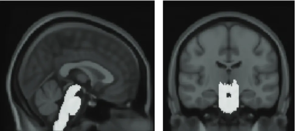 Figure 2: Brain-stem atlas image. The brain-stem atlas was defined manually on the International Consortium for Brain Mapping (ICBM) 152 template.