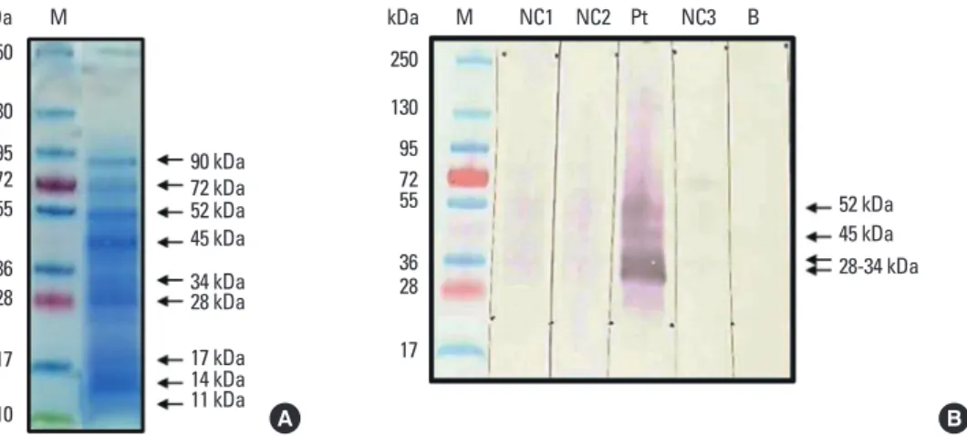 Fig. 3.  Sodium dodecyl sulfate polyacrylamide gel electrophoresis (SDS-PAGE) (A) and IgE-immunoblot analysis (B) of bee-pollen extracts in sera of the patient and  normal controls (NC)