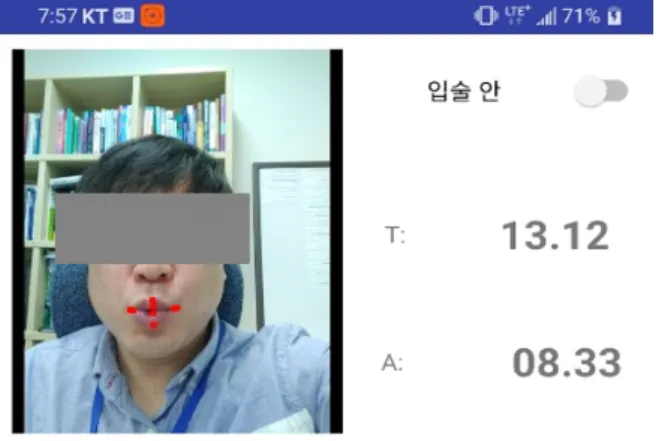 Figure 3. The range of movement of the lips when /wi/ production 