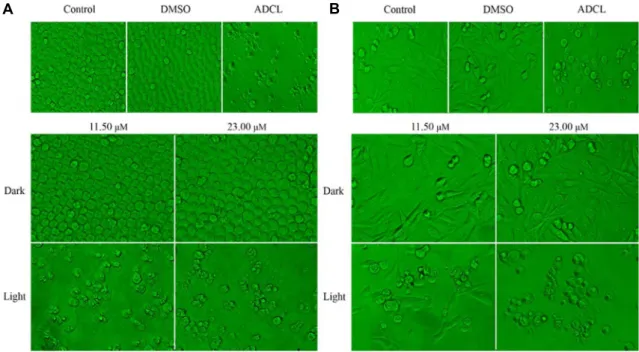 Fig.  4.  Morphological  changes  in  U937  and  SK-HEP-1  cells  treated  with  NC-1  and  light