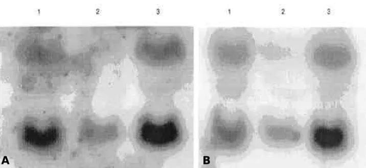 Figure 3. The effect of cofactor and deletions on the expression level of TH mRNA. A. To determine the steady state expression lev- lev-els of TH mRNA 20  ㎍ of total RNA isolated from d19THN (lane 1), wTHN (lane 2), wTHGCN (lane 3) are separated on 1%