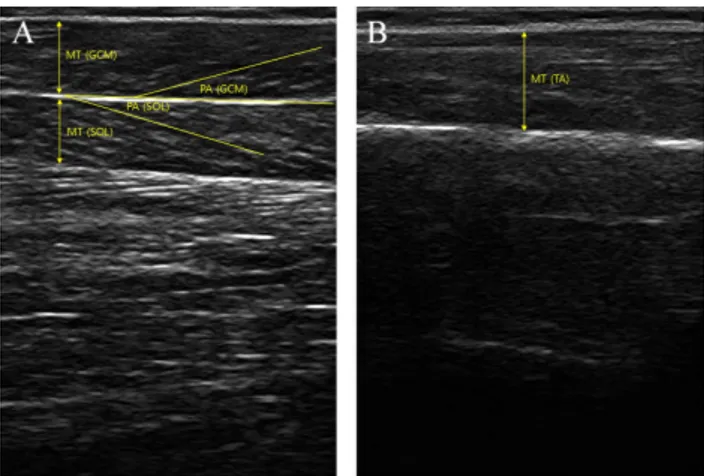 Figure 1. Ultrasound image of muscle thickness (MT) and penna- penna-tion angle (PA) of (A) triceps surae and (B) tibialis anterior.Procedures