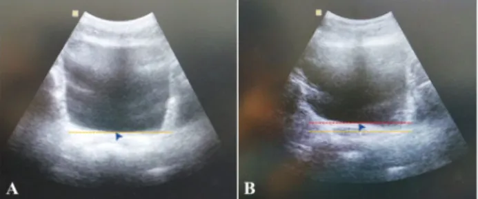 Figure 2. Education using a mobile game-based extracorporeal bi- bi-ofeedback device (EBD)