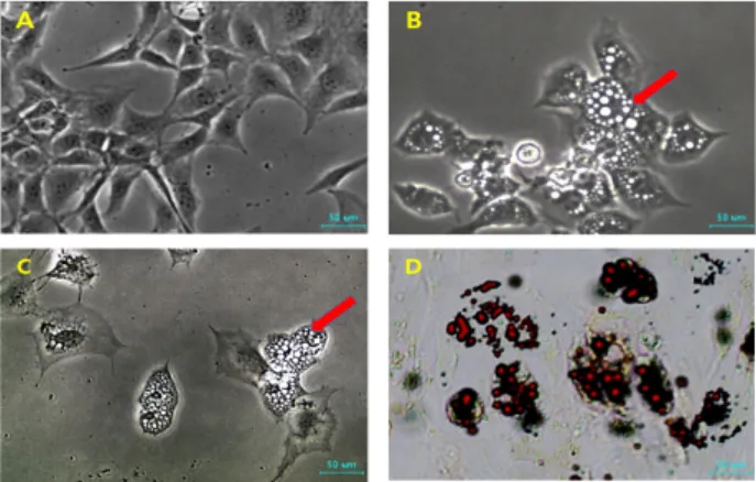 Fig.  4.  3T3-L1  cells  before  differentiation  into  adipocyte  (A)  were  exposed  to  in  adipocyte  differentiation  medium  containing  control  (B)  and  10  μM  EGCG  (C)  for  2  weeks  and  formation  of  neutral  lipid  droplets  (arrows)  was 