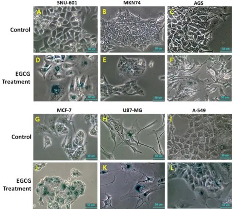 Fig.  7.  Change  in  cell  morphology  and  SA-gal  activity  in  untreated  control  (A,  B,  G,  H  and  I)  and  10  μM  EGCG-treated  (D,  E,  F,  J,  K  and  L)  in  each  cancer  cell  lines