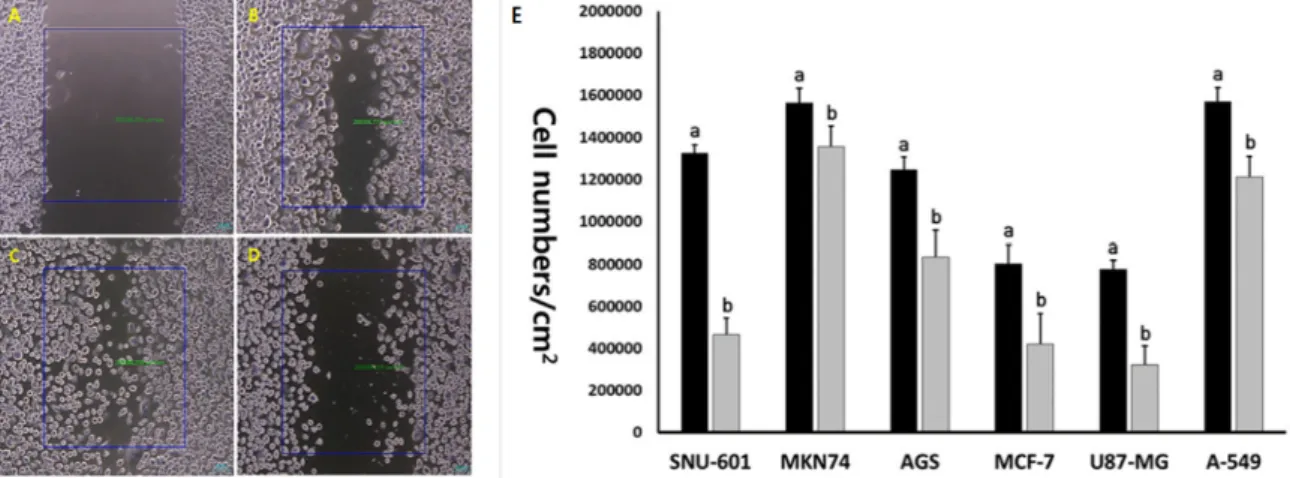 Fig.  8.  Cell  migration  test  using  wound  healing  assay  in  SNU-601  cells  after  scratch  (A),  control  SNU-601  cells  after  24  hr  (B),  48  hr  (c)  and  10  μM  EGCG-treated  SNU-601  cells  for  48  hr  (D)