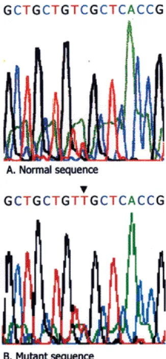 Figure 5. Nuleotide sequence of the relevant region of exon 5 of CHRNA4 gene. Arrow indicates the position of the  mutat-ed 755 nucleotide