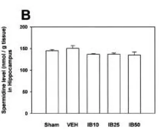 Figure 2. Changes of putrescine (A), spermidine (B), and spermine (C) levels in the gerbil hippocampus after global ischemia and effects of ibuprofen administration