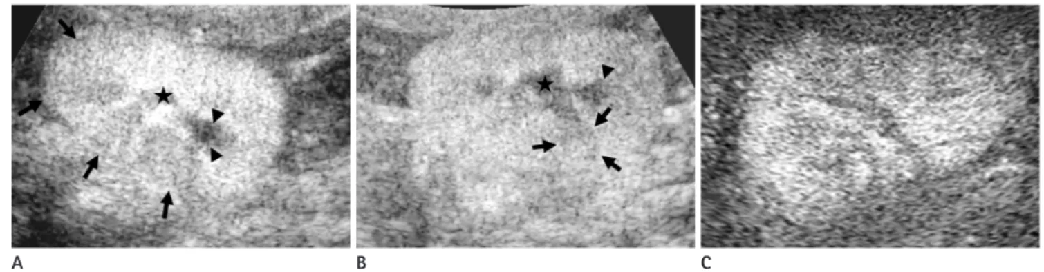 Fig. 4. Parenchymal abnormalities of acute pyelonephritis in rabbits. 