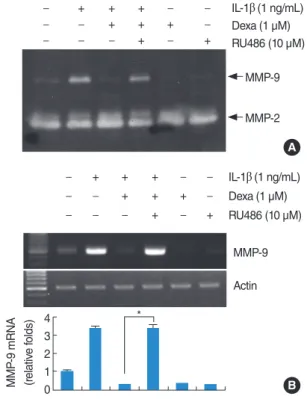 Fig. 2. Effect of dexamethasone on interleukin (IL)-1β induced matrix  metalloproteinase (MMP)-9 activity and MMP-9 mRNA expression