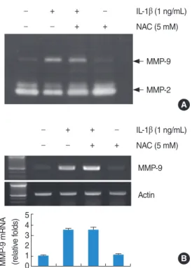 Fig. 5. The p38 mitogen-activated protein kinases (MAPK) signaling  pathways play important roles in interleukin (IL)-1β-induced matrix  metalloproteinase (MMP)-9 activity and mRNA expression in house  ear institute-organ of Corti 1 (HEI-OC1) cells
