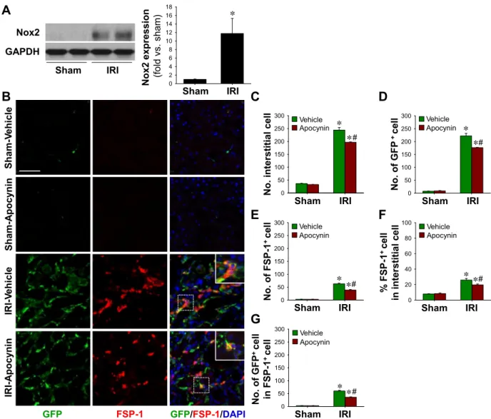 Fig. 4. BMDC and fibroblast accumulation in IRI kidneys and its inhibition by apocynin