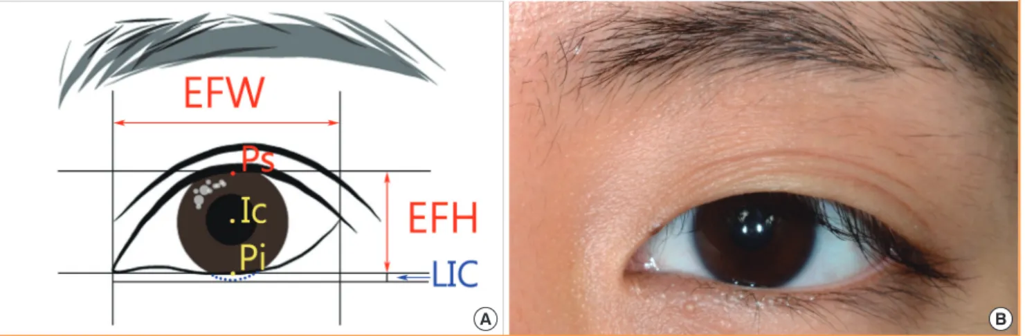 Fig. 3. Diagram indicating the EFI and LIC 