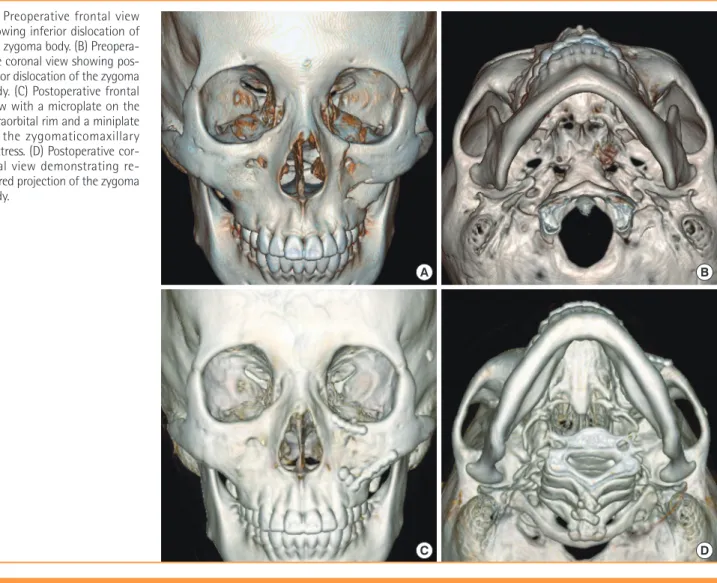 Fig. 5. Three-dimensional computed tomography of the patient case
