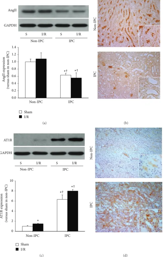 Figure 2: Expression of AngII and AT1R in non-IPC and IPC kidneys. IPC or non-IPC mice were exposed to either 30 minutes of bilateral renal ischemia/reperfusion (I/R) or a sham-operation (Sham)