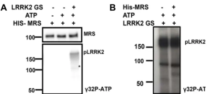 Fig.  3.  Over-expression  of  MRS  or  LRRK2  does  not  increase  sta- sta-bility  of  the  partner  protein