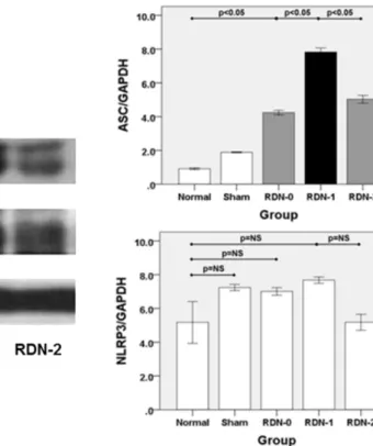 Fig.  5.  ASC  and  NLRP3  expression  associated  with  myocardial  damage  after  RDN