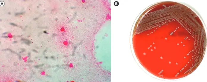Fig. 1.  Microscopic and colonial morphology of Pasteurella canis. (A) Gram-negative coccobacilli on a direct gram-stained smear from the  wound specimen (×1,000)