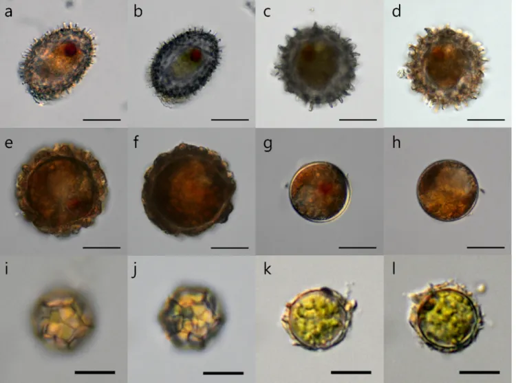 Fig 6. The effects of DNA debris removal process on various algal cysts. Before (a, c, e, g, i, k) and after (b, d, f, h, j, l) treatment with the optimal DNA debris removal method (75°C DW) for a variety of cysts of different types and sizes isolated from