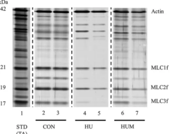 Table 1 summarizes the contractile characteristics for single fiber diameter, force generating capacity, and specific force in MHC type IIB fibers