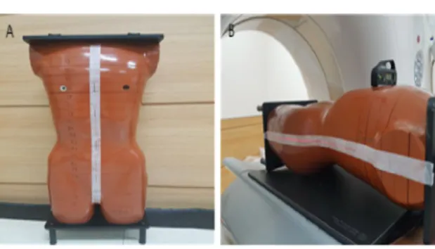 Fig.  1.  (A)  The  guideline  to  phantom  for  laser  alignment  in  CT  setup,  (B)  The  laser  alignment  for  Phantom's  isocenter  setup