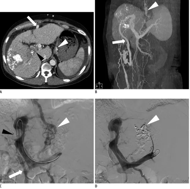 Fig. 1. 52-year-old man presented with melena.