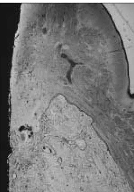 Fig. 8.  Attachment  finding  of  dense  connective  tissue between ITI implant and gingiva(H/E, ×100).