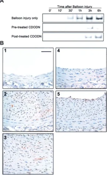 Figure 7. A, Analysis of AP-1 binding activity in arterial extracts.