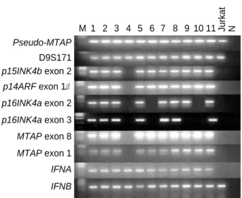 Fig. 2. Polymerase chain reaction/single strand conformational poly- poly-morphism (PCR/SSCP) analysis of p16IN4a exon 2 in the  represen-tative cases of primary glioblastomas (1-9)