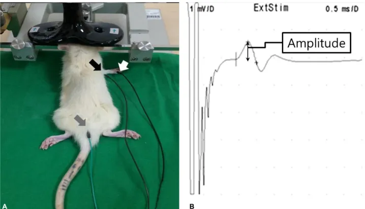 Figure 2. Active (black arrow), reference (white arrow), ground (gray arrow) electrode and the coil position (A) and the  representative motor evoked potential (B).