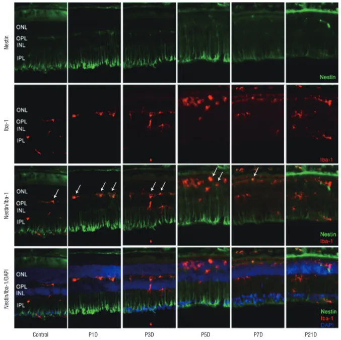 Fig. 1. Nestin and Iba-1 expression in control and degenerated adult mouse retina. Immunofluorescent labeling with nestin (green), Iba-1(red), and DAPI (blue) is shown