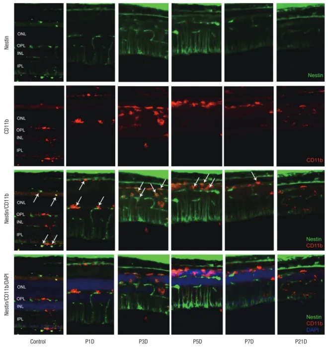 Fig. 2. Nestin and CD11bexpression in control and degenerated adult mouse retina. Immunofluorescent labeling with nestin (green), CD11b (red), and DAPI (blue) is shown